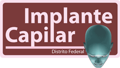 IMPLANTE CAPILAR - BLOG - Implantes e Transplantes para Cabelos - Brasília, DF